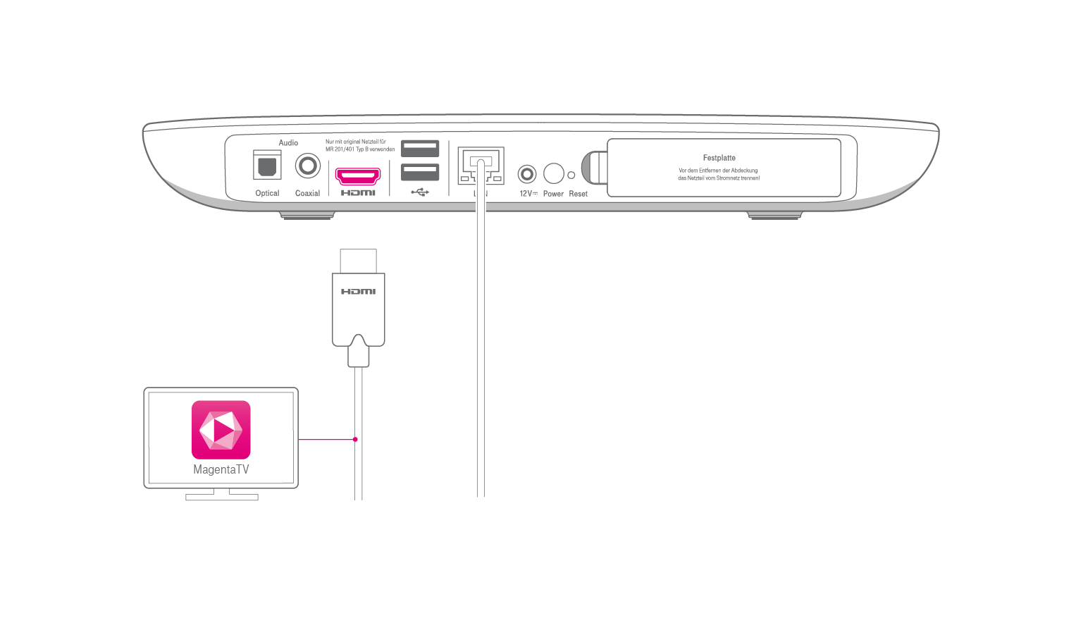 Media Receiver Installation | Telekom Hilfe